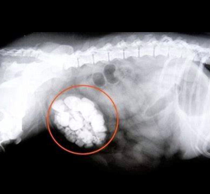 What Diet Helps after Removal of Bladder Stones?